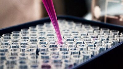 How to conduct tests to detect the parasites in the body